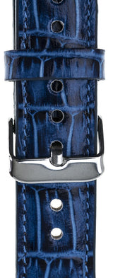 Apple Watch Uyumlu Deri Kordon Croco YK07